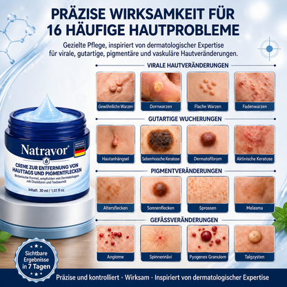 Natravor® 𝟕-𝐓𝐚𝐠𝐞 𝐇𝐚𝐮𝐭𝐚𝐧𝐡ä𝐧𝐠𝐬𝐞𝐥- & 𝐅𝐥𝐞𝐜𝐤𝐞𝐧-𝐄𝐧𝐭𝐟𝐞𝐫𝐧𝐮𝐧𝐠𝐬𝐜𝐫𝐞𝐦𝐞 (𝐒𝐜𝐡𝐦𝐞𝐫𝐳𝐟𝐫𝐞𝐢𝐞 𝐅𝐨𝐫𝐦𝐞𝐥 – 𝐨𝐡𝐧𝐞 𝐍𝐚𝐫𝐛𝐞𝐧) 🎉c