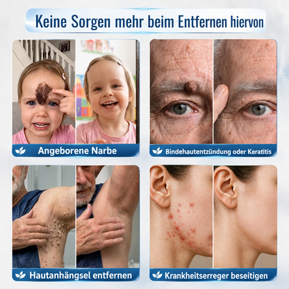 Natravor® 𝟕-𝐓𝐚𝐠𝐞 𝐇𝐚𝐮𝐭𝐚𝐧𝐡ä𝐧𝐠𝐬𝐞𝐥- & 𝐅𝐥𝐞𝐜𝐤𝐞𝐧-𝐄𝐧𝐭𝐟𝐞𝐫𝐧𝐮𝐧𝐠𝐬𝐜𝐫𝐞𝐦𝐞 (𝐒𝐜𝐡𝐦𝐞𝐫𝐳𝐟𝐫𝐞𝐢𝐞 𝐅𝐨𝐫𝐦𝐞𝐥 – 𝐨𝐡𝐧𝐞 𝐍𝐚𝐫𝐛𝐞𝐧) 🎉c